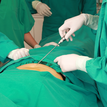 Liposuction equipment and cannula